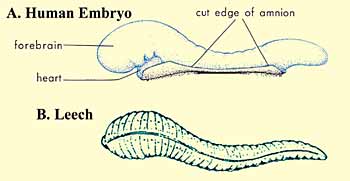 Drawings illustrating the similarities in appearance between a leech and a human embryo at the alaqah stage.