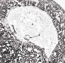 Photomicrograph showing the suspension of an embryo (marked B) during the alaqah stage (about 15 days old) in the womb of the mother. The actual size of the embryo is about 0.6 mm.