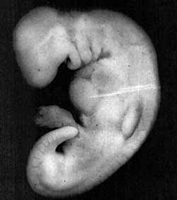 Photograph of an embryo at the mudghah stage (28 days old). The embryo at this stage acquires the appearance of a chewed substance, because the somites at the back of the embryo somewhat resemble teeth marks. Actual size: 4 mm.